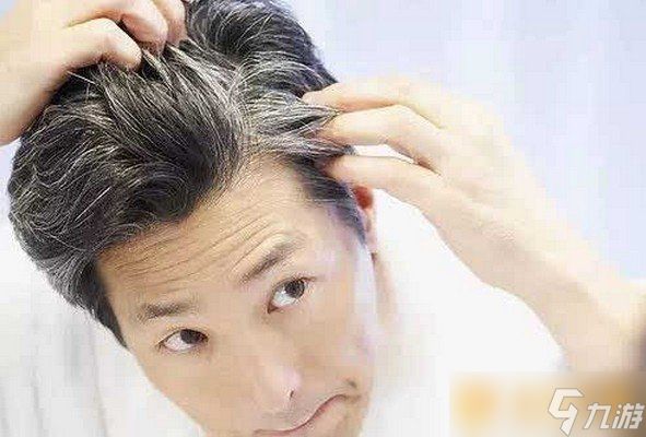 年纪轻轻就长白头发是肾不好吗