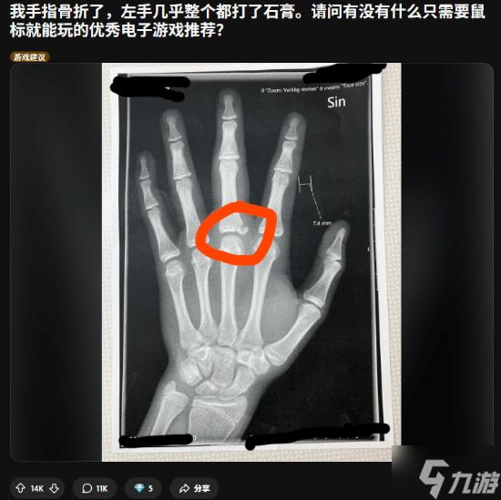 左手骨折也要玩！玩家求助 网友狂推"单手友好"游戏