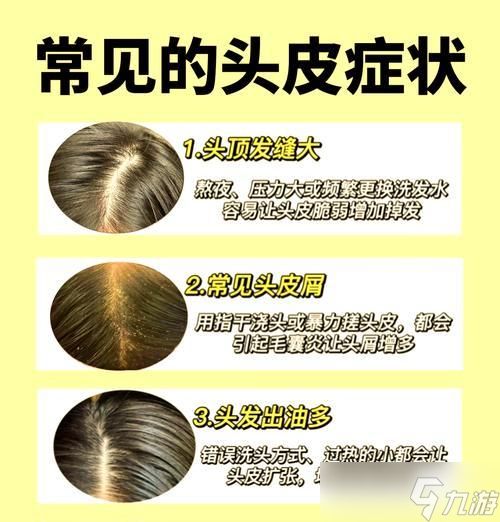 副本中怎样才能触发掉落头发？